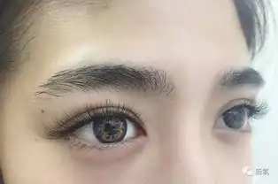 金星老师医美讲堂当年林志玲的单眼皮小龅牙呢