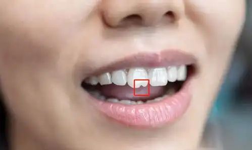 门牙前的豁真是嗑瓜子惹的祸多年来的困惑终于解开了