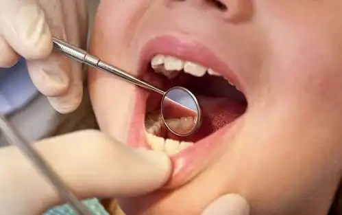 岳西第一批90后已经缺牙了,都是自己惹的祸