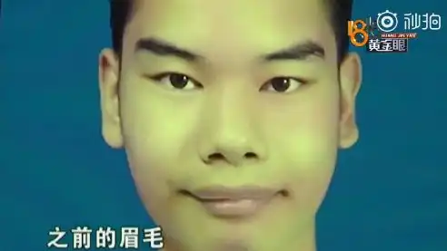 发际线男孩刷屏朋友圈,网友纷纷为他做表情包明明很心疼,为什么我这么想笑