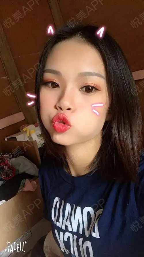 来贡献一组表情包,闺蜜说好像邓紫棋的金鱼双眼皮宽...眼型矫正悦美整形