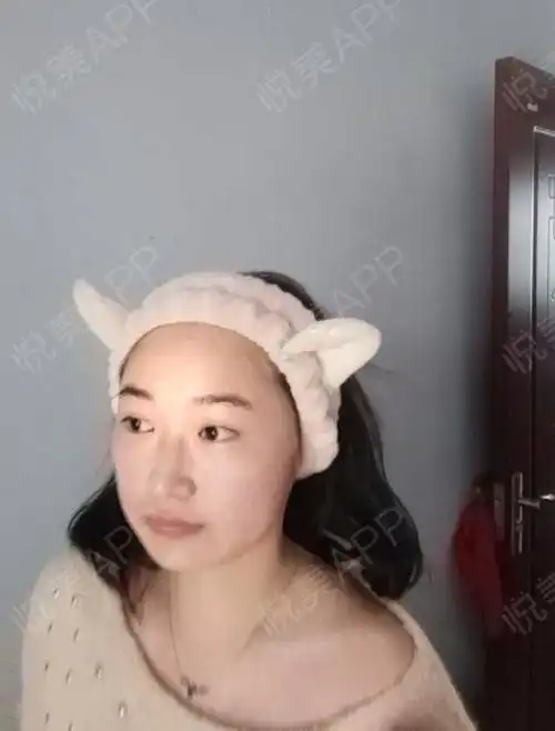 真心的建议女孩们一定不要长胖,最近有一个身边的例子...瘦脸悦美整形