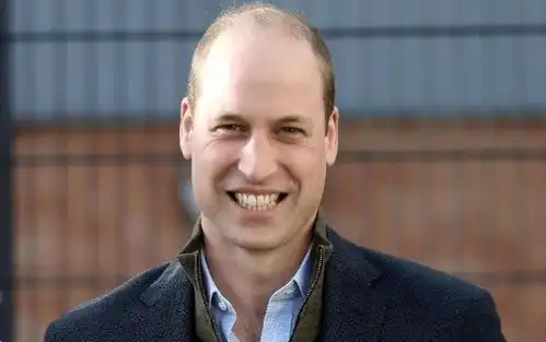 英国王室男性成员个个秃头,威廉王子年轻时金发浓密,如今秃光了