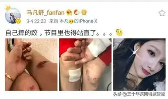 天下足球长腿美女主播弄伤膝盖自己摔的跤节目里也得站直