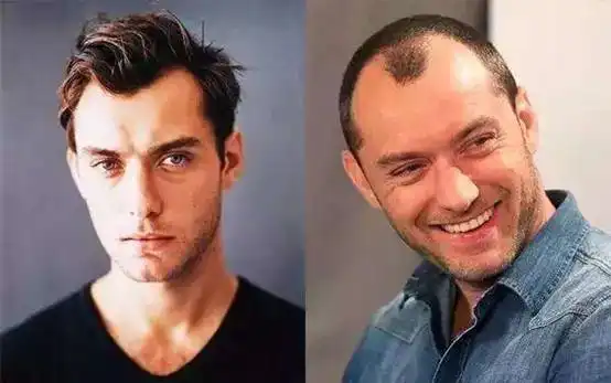 50岁秃头男人照片搞笑