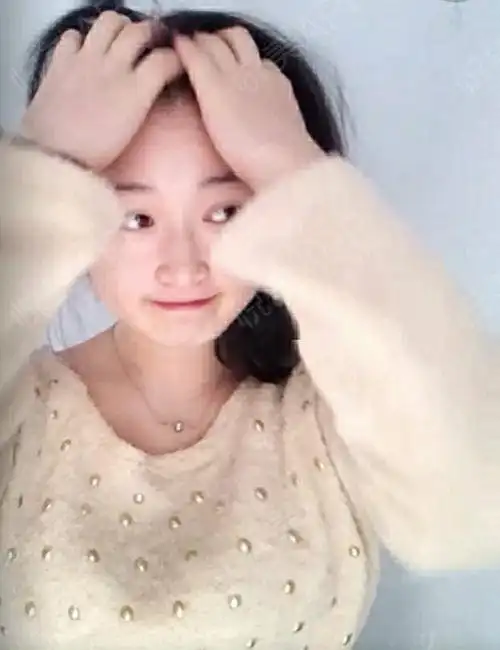 真心的建议女孩们一定不要长胖,最近有一个身边的例子...瘦脸悦美整形