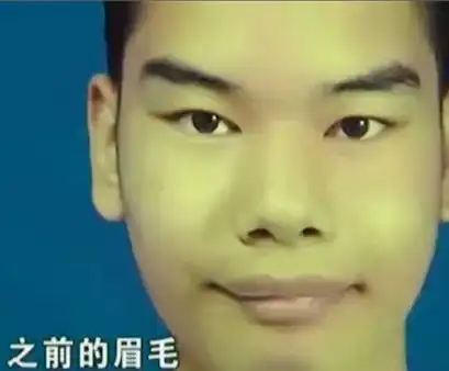 杭州发际线男孩表情包惊