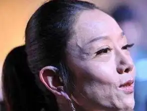 杨丽萍常年戴帽子,本以为是装饰,当她摘下帽子那一刻让人心疼