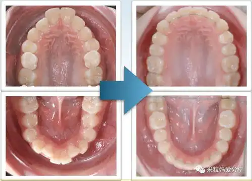 小s变化这么大,可这其中的秘密当家长的一定要知道