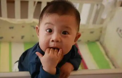 1岁宝宝噘金鱼嘴卖萌,掰开孩子嘴后吓坏全家,医生胡闹