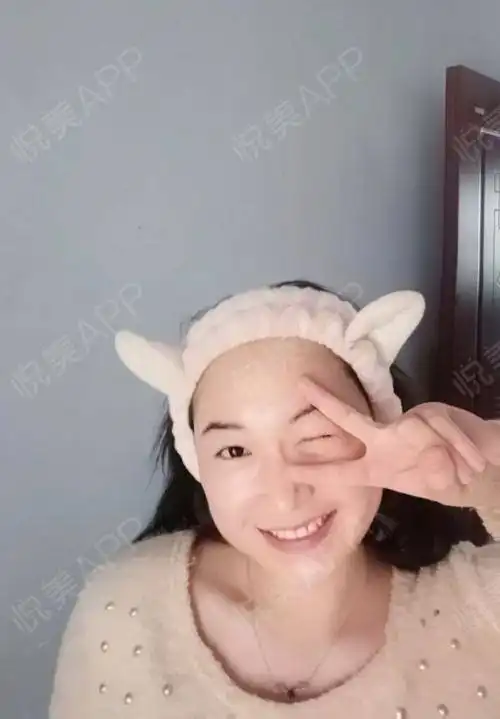 真心的建议女孩们一定不要长胖,最近有一个身边的例子...瘦脸悦美整形