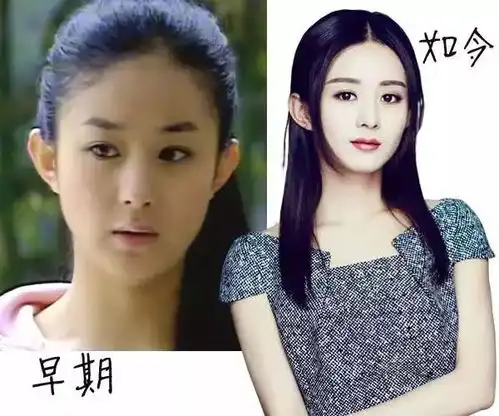 是整容还是化妆农村女孩赵丽颖容貌变化