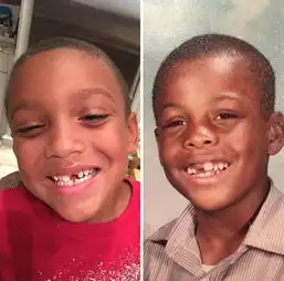 门牙掉了表情包