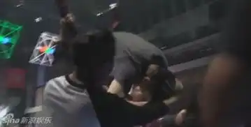 潘玮柏演唱会彩排摔落舞台现场照片曝光2次缝合伤势稳定